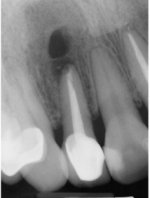 tooth9.jpg