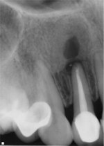 tooth9a.jpg