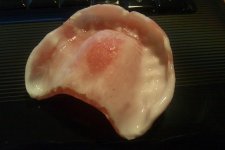 denture reline 1.2.jpg denture reline 1.2.jpg