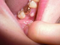 tooth.JPG