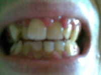 Before.jpg