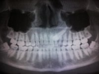 xray.jpg xray.jpg