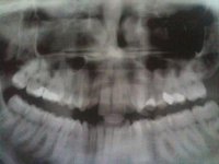 X-Ray 1.jpg