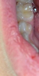Middle tooth.jpg