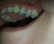 tooth2.jpg tooth2.jpg