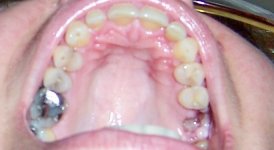 tooth2.jpg