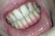 untitledteethjpeg.JPG