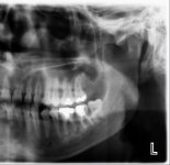 xray.jpg