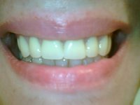 My smile.jpg