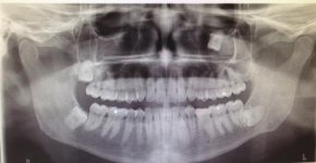 xray.jpg xray.jpg