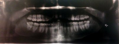 teeth.jpg