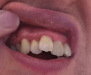redGum.jpg