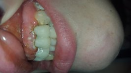 20160606_142612.jpg