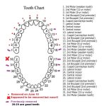 tooth-chart.jpg