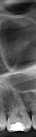 xray1.jpg