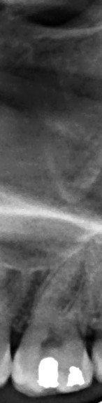 xray2.jpg