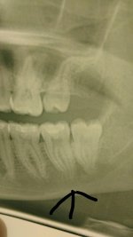 IMG_20170107_055107.jpg