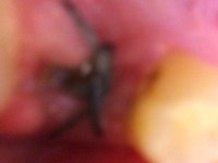 tooth1.JPG tooth1.JPG