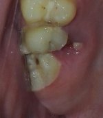 tooth.jpg