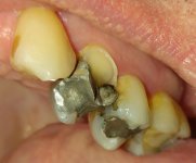 Broken-Tooth-web.jpg