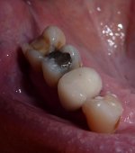 New Crown 24-1-2018.jpg
