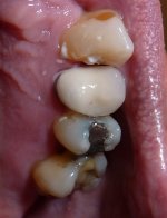 Crown 24-1-2018.jpg