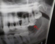 tooth2.jpg tooth2.jpg
