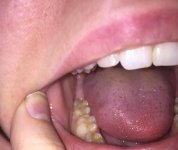 tooth.jpg