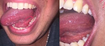 Mouth.jpg