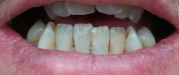 20180914_125130-2-1.jpg
