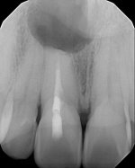 x-ray.jpg