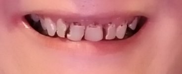 20181010_200316.jpg 20181010_200316.jpg