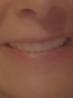 temp teeth.jpg temp teeth.jpg