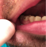 Teethscreenshot.png