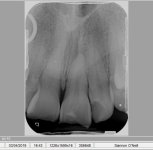 front teeth.JPG
