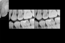 XRAYS copy.png