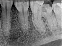 xrays p2.PNG