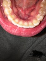 36172633-56B9-4D18-9C2C-CB7C71B0D083.jpeg