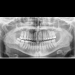 Xray.JPEG
