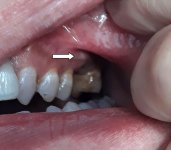 Tooth pic.jpg