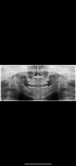 16E279E7-DA8E-4ECB-B47C-594D2AEC8CF6.png