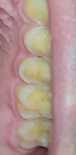 IMG_20210704_234025.jpg