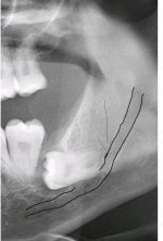 tooth close up.jpg