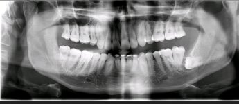 x-ray.jpg