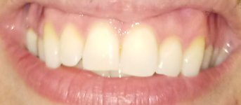 IMG_20211210_215658.jpg
