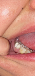 tooth.png