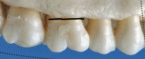 340537_1_En_8_Fig1_HTML.gif 2 (2).jpg