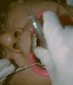 teeth cleaning.jpg