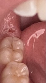 IMG_1034.jpeg