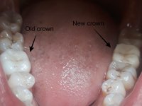 New Crown 5.jpg